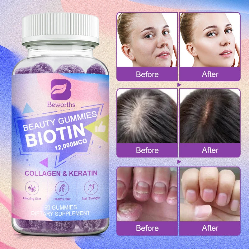 Collagen Biotin Gummies – Hair, Skin & Nail Support Peaceful Pleasures Health and Wellness