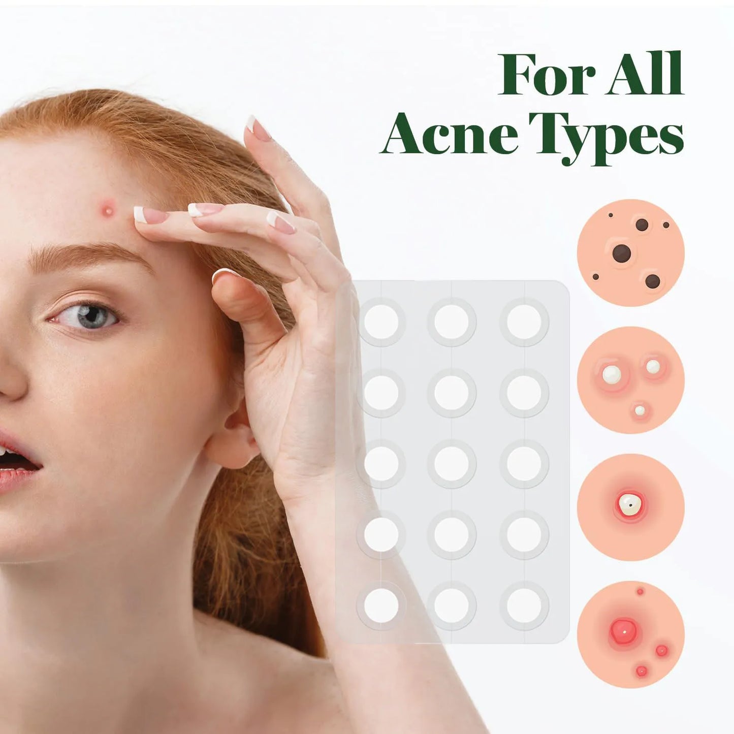 Invisible Waterproof Hydrocolloid Acne Patches – All Skin Types