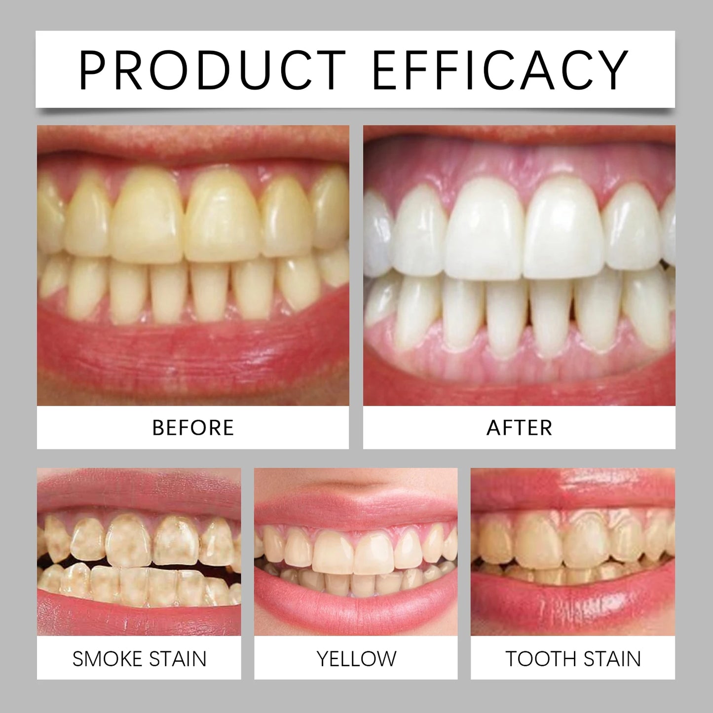 Natural Teeth Brightening Powder | Baking Soda Dental Polish