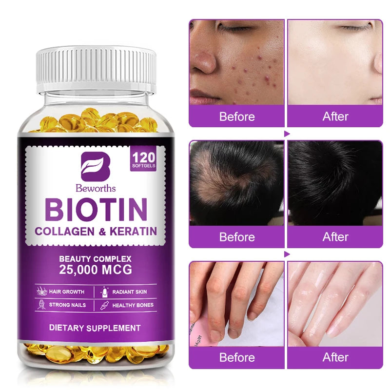 BBEEAAUU Biotin Capsules – Hair Growth, Follicle Repair & Skin Hydration Dietary Supplement Peaceful Pleasures Health and Wellness