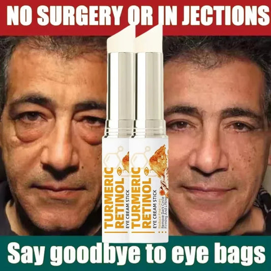 SADOER Retinol Eye Cream – Brighten, Firm & Hydrate Eye Cream Oasis Select