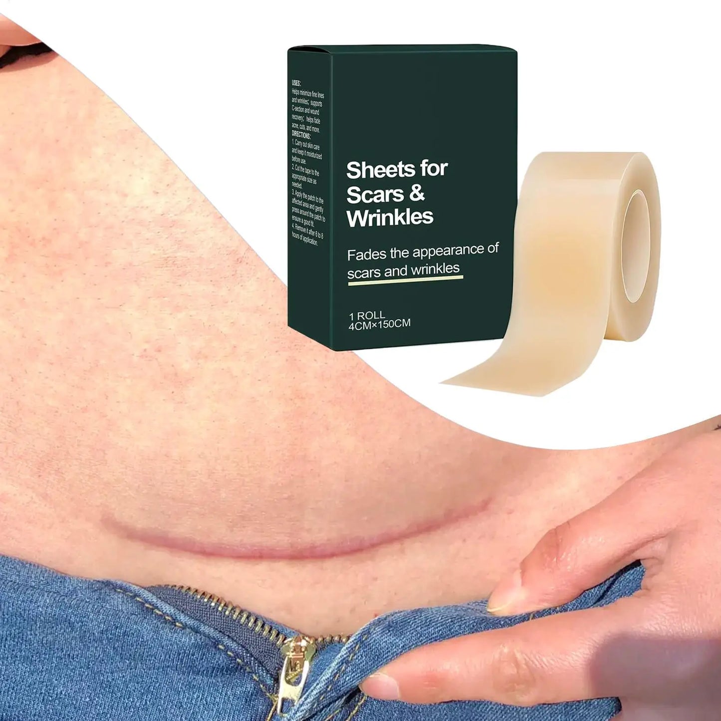 Silicone Scar Sheet Roll 4cm×150cm – Cuttable Skin Care Strip