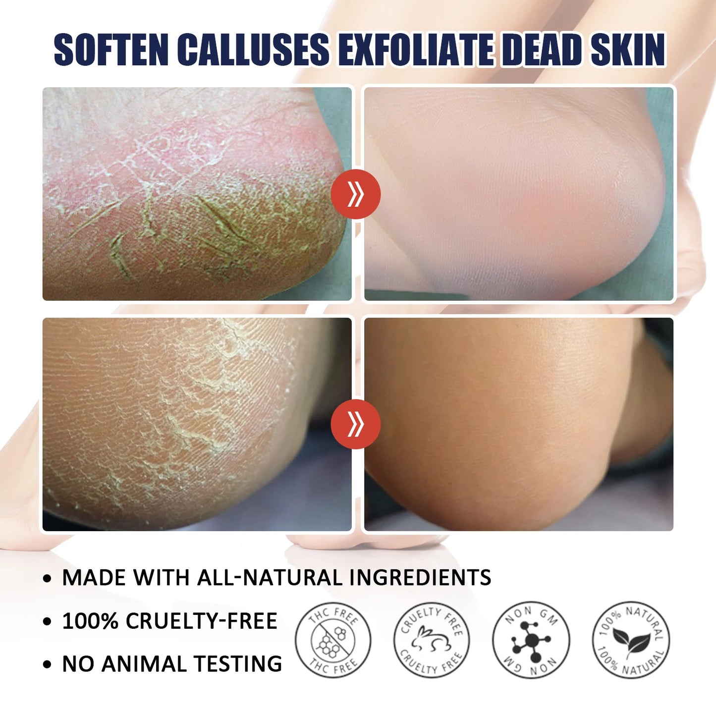 Jaysuing Shea Butter Hand & Foot Cream – Non-Greasy Moisturizer