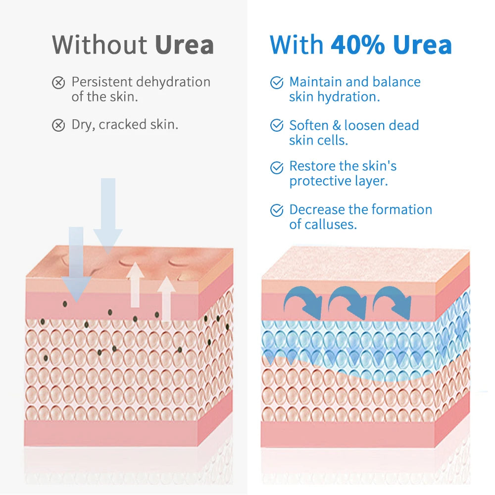 New 42% Urea Cream + 2% Salicylic acid Foot and hand Moisturizer, deep moisturizer and Nourishing moisturizer Peaceful Pleasures Health and Wellness