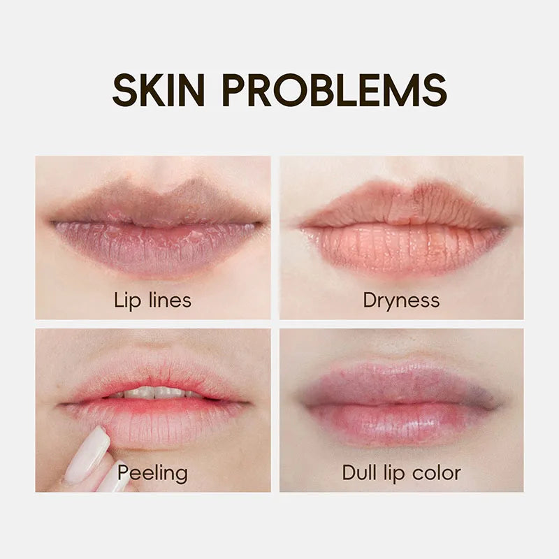 24K Gold Collagen Lip Mask – Hydrating Plumping Gel Patches 10pc