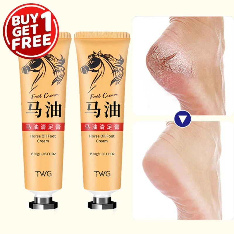 Ma You Qing Moisturizing Foot & Hand Cream – Dry Skin 30g