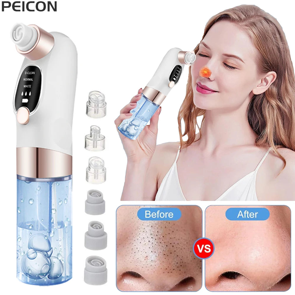 Electric Blackhead Remover Pore Vacuum Cleaner Facial Black Dots Vacuum Cleaner Pimple Acne Blackhead Removal Black Dots Remover Peaceful Pleasures Health and Wellness