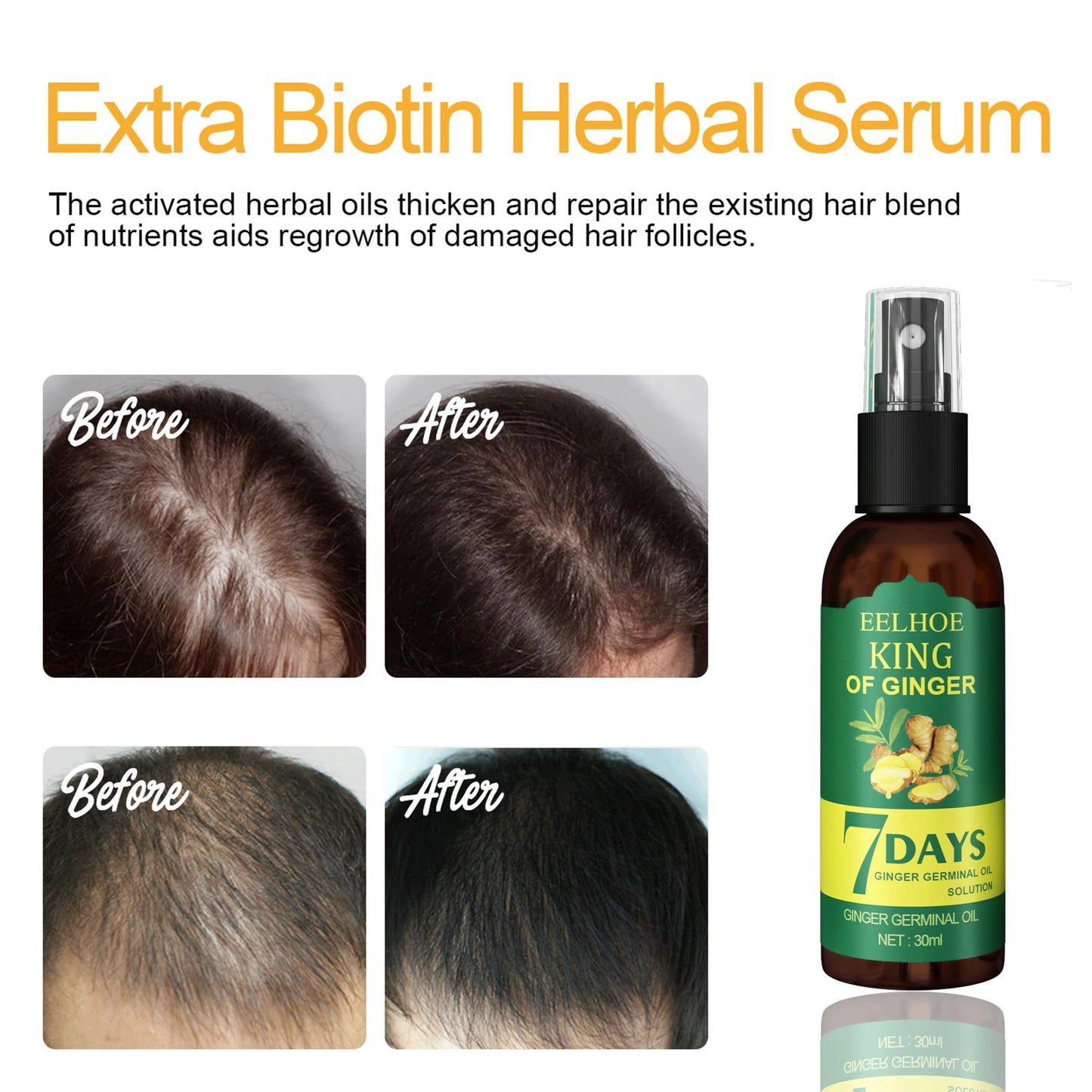 Ginger Root Scalp Serum Spray – Nourishing Mist for Dry Frizzy Hair