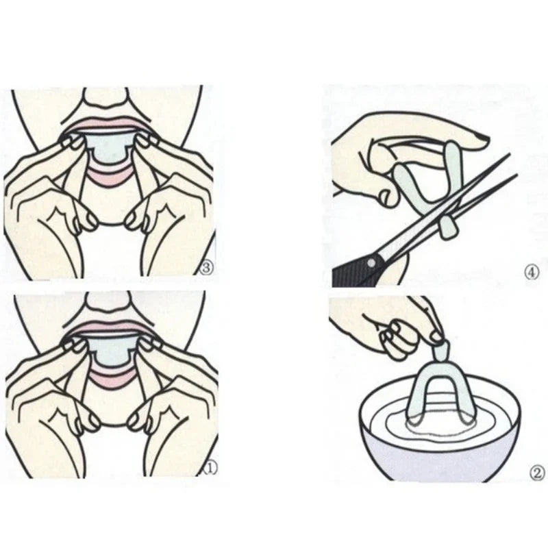 Night Guard for Teeth Grinding & Snoring – 1/2/4 Pack Mouth Tray