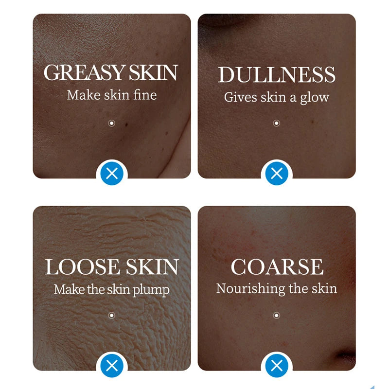 SADOER Ice Face Sheet Masks 5pc | Hydrating & Brightening
