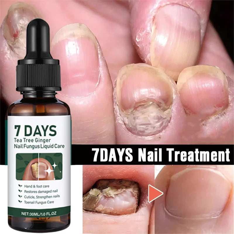 Eelhoe Nail Repair Serum – Ginger Extract for Healthy Nails