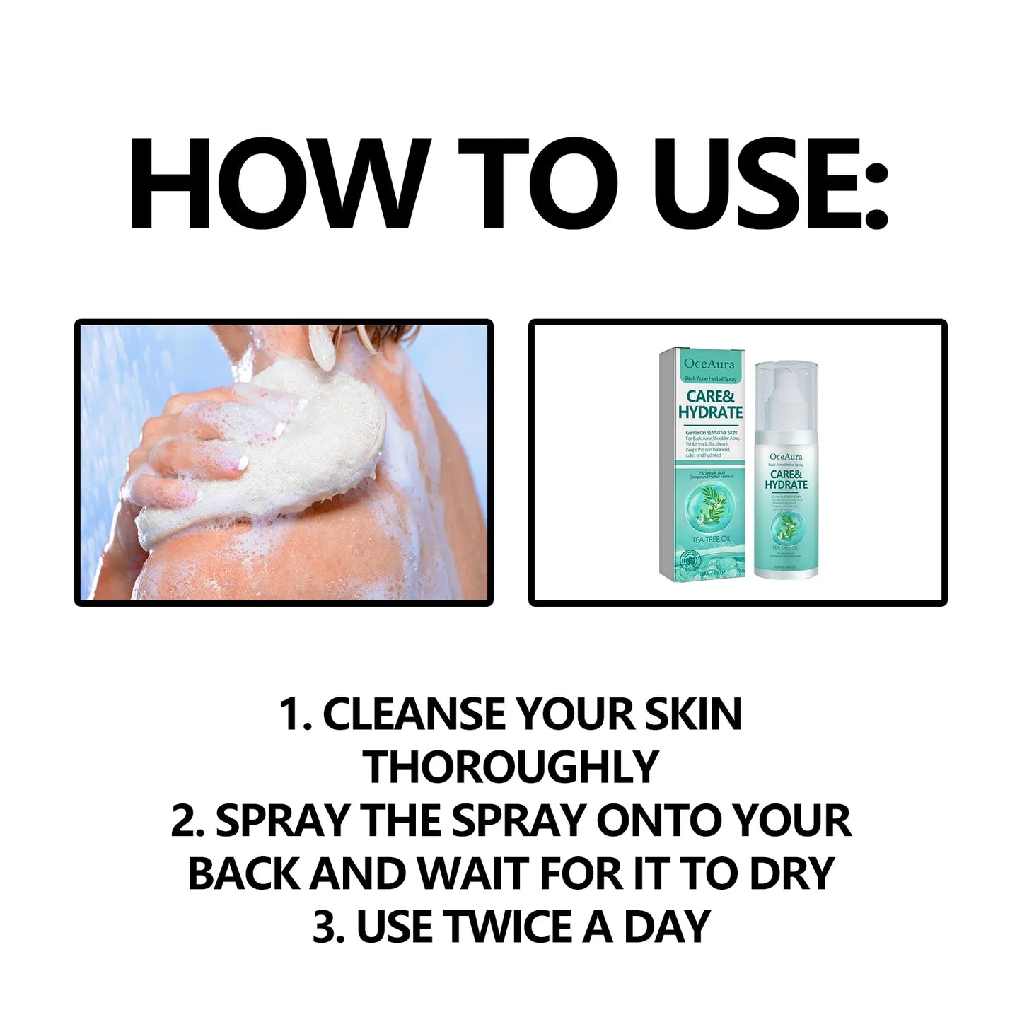 OceAura Herbal Acne Spray – Back, Shoulder & Pore Treatment