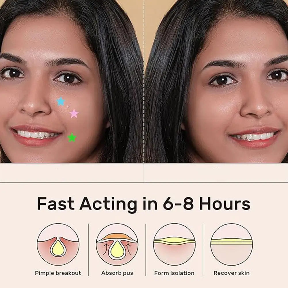 eelhoe Colorful Hydrocolloid Acne Pimple Patches – Cute Star & Heart Shaped Blemish Cover Stickers | 168–252 Pcs Peaceful Pleasures Health and Wellness