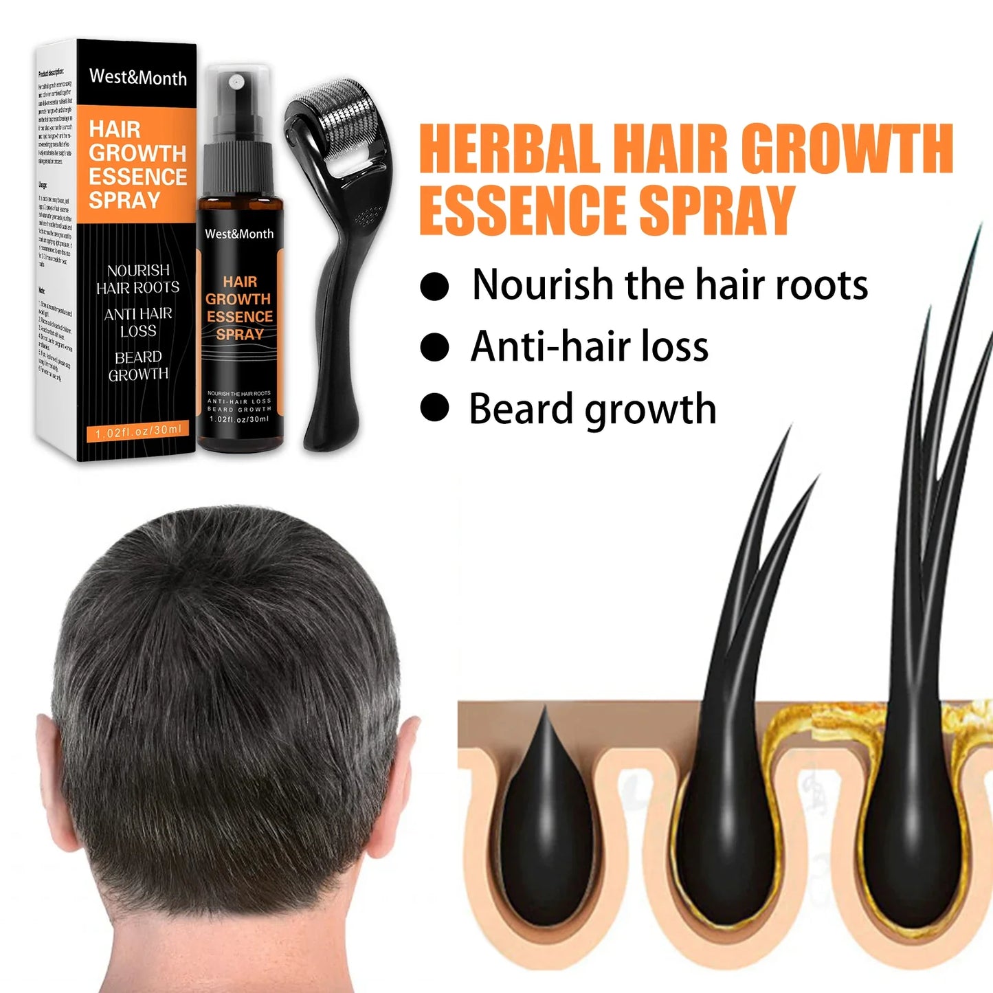 Hair Thickening Scalp Spray – Polygonum & Ginger Nourishment