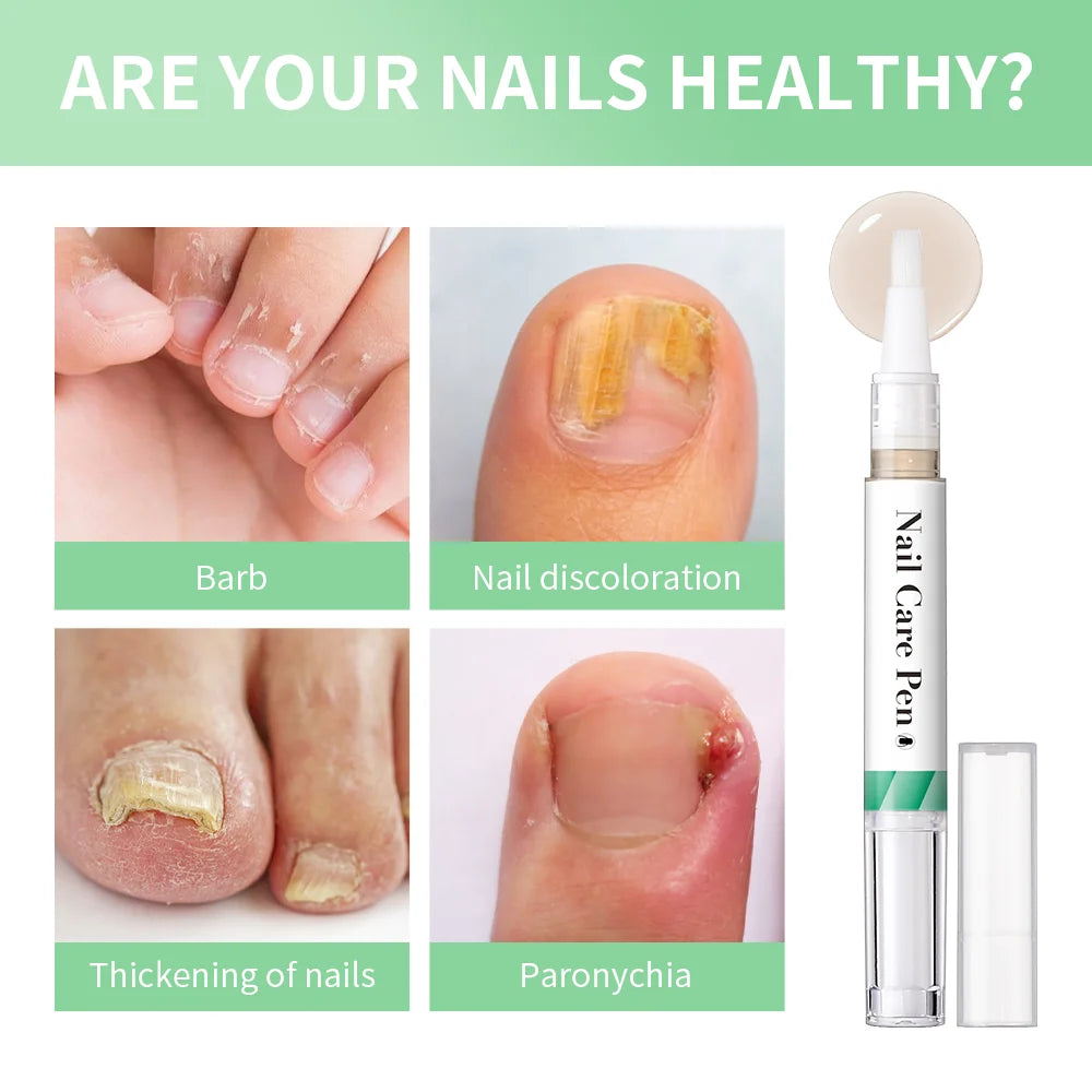 Nail Care Pen Nourish and Moisturize Nails Prevent Fungal Infections Improve Appearance Flat Brush Head Design Daily Nail Care Peaceful Pleasures Health and Wellness