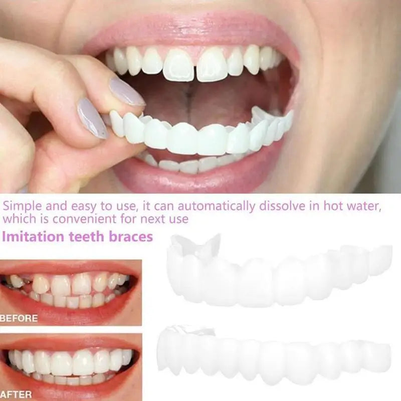Snap-On Teeth Veneers – Reusable Smile Cover for Men & Women