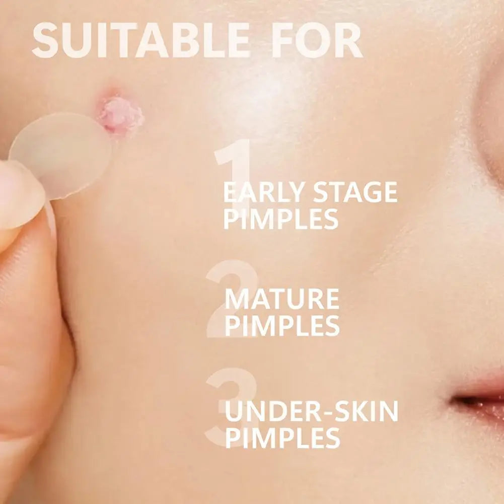 Microneedle Pimple Patches – Hydrocolloid Micropoint Acne Spots