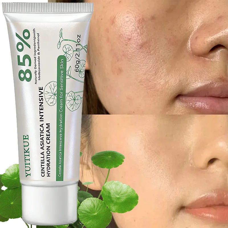 YUITIKUE Centella Asiatica Intensive Hydration Cream 60g 85% Natural Formula for Deep Moisturizing & Sensitive Skin Peaceful Pleasures Health and Wellness
