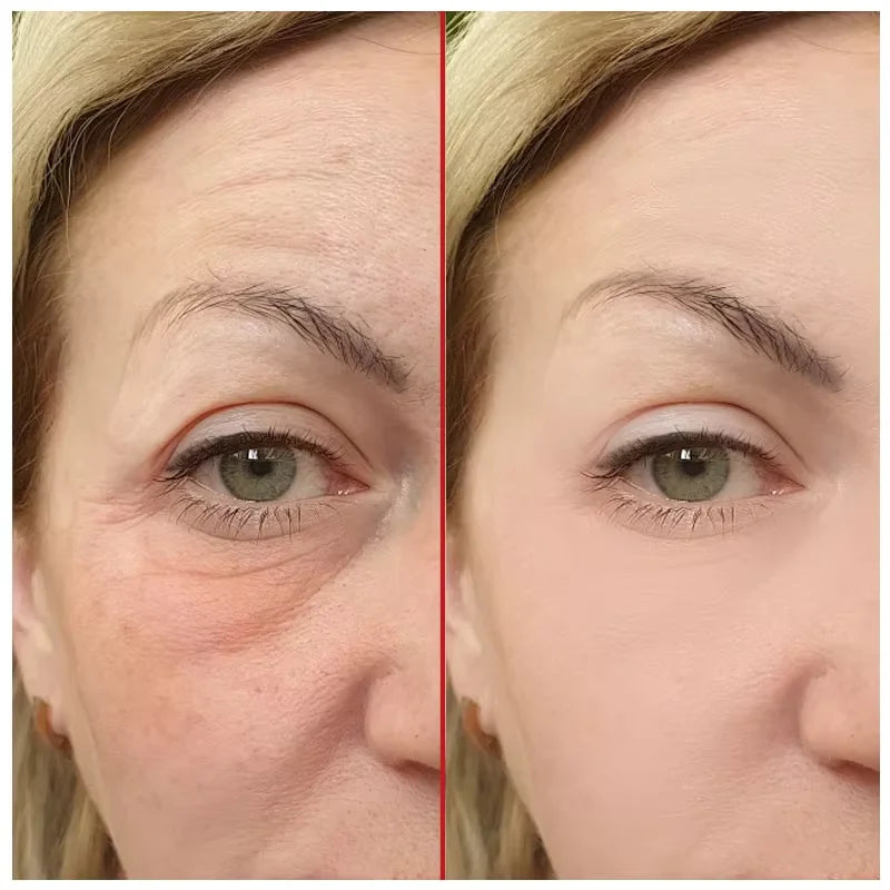 30g Retinol Wrinkle Removal Cream Fade Face Eye Fine Line Instant Anti Aging Whitening Anti-Wrinkle Dark Circles Dismiss Cream Peaceful Pleasures Health and Wellness