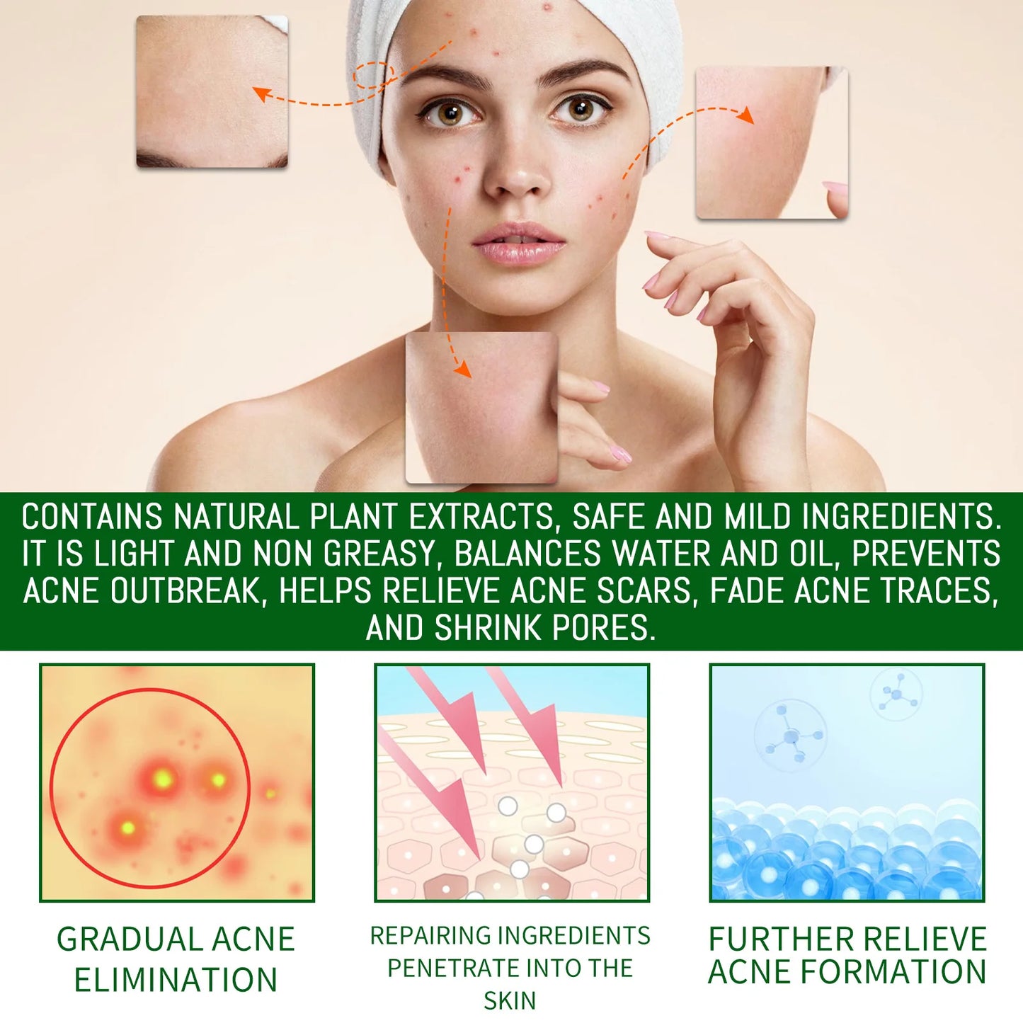 Salicylic Acid Acne Face Serum – Pores, Blackheads & Oil
