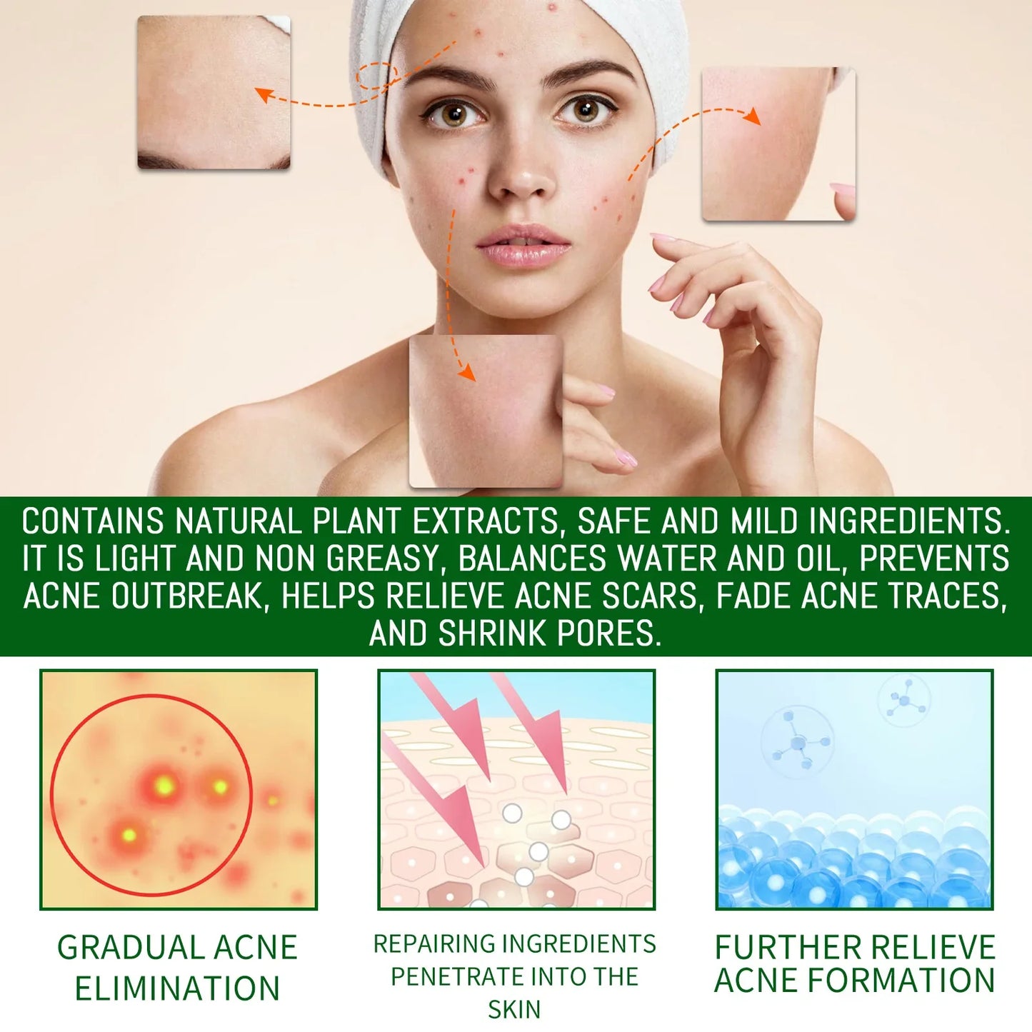 Salicylic Acid Acne Face Serum – Pores, Blackheads & Oil