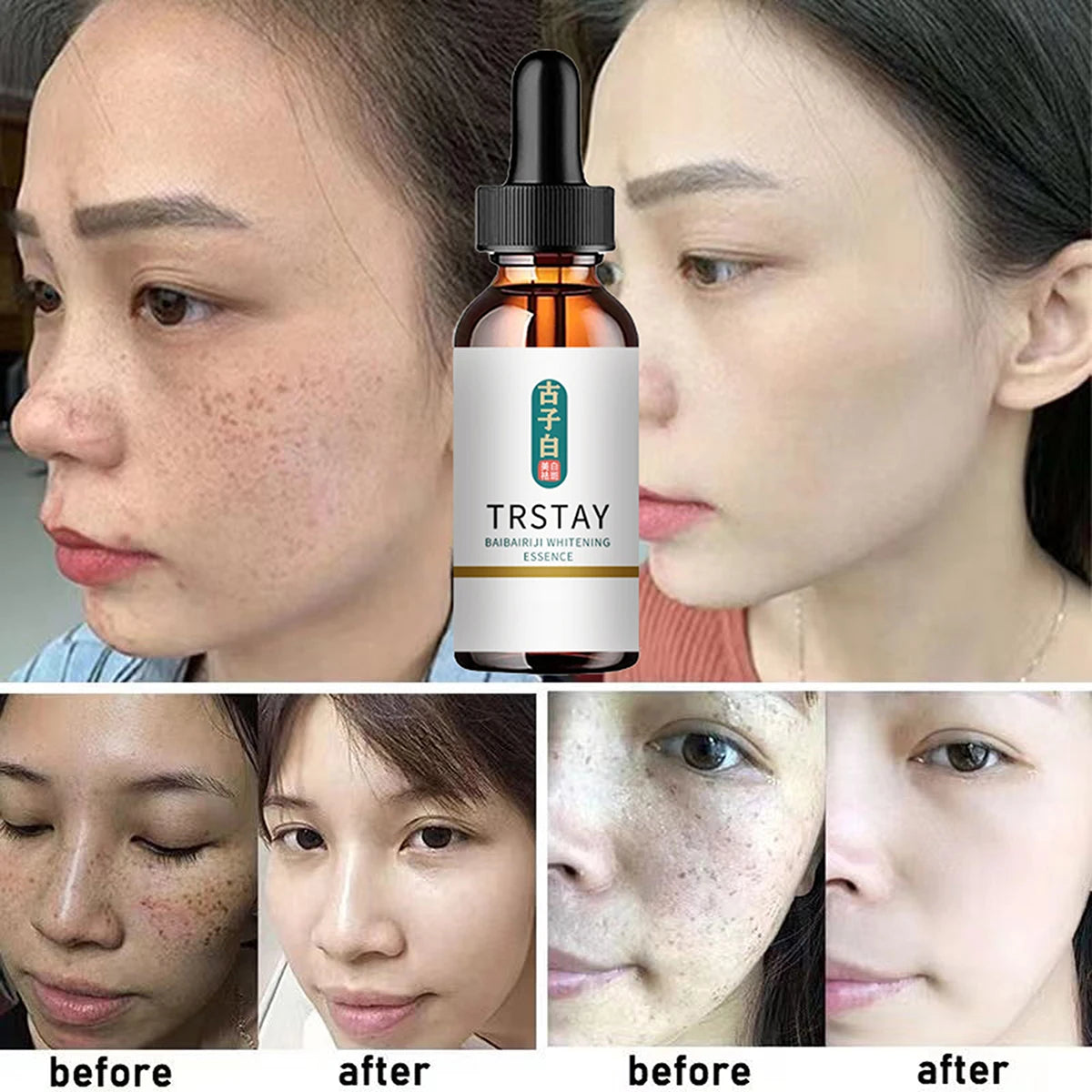Effective Whitening Serum Remove Dark Spots Freckle Essence Anti-Aging Fade Pigmentation Melasma Brighten Beauty Face Skin Care Peaceful Pleasures Health and Wellness