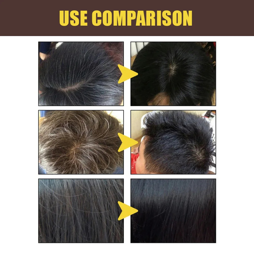 3-in-1 Dark Brown Hair Color Shampoo | Herbal, 100ML