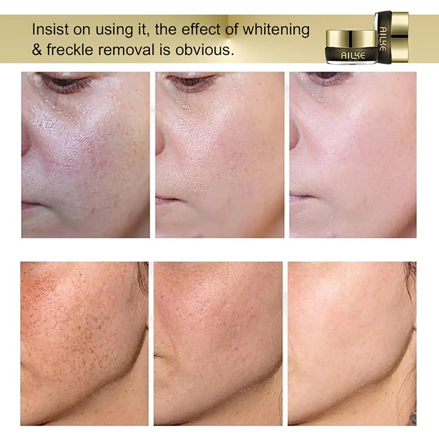 AILKE Whitening Face Cream | Collagen, Glutathione, Dark Spots