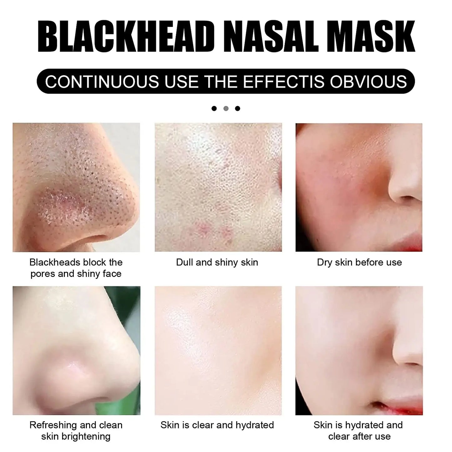 100/50/10 Pieces Of Nose Cleaning Stickers, Remove Blackheads And Acne, Deep Clean Pores, Absorb Oil And Dirt, Nose Mask Sticker Peaceful Pleasures Health and Wellness