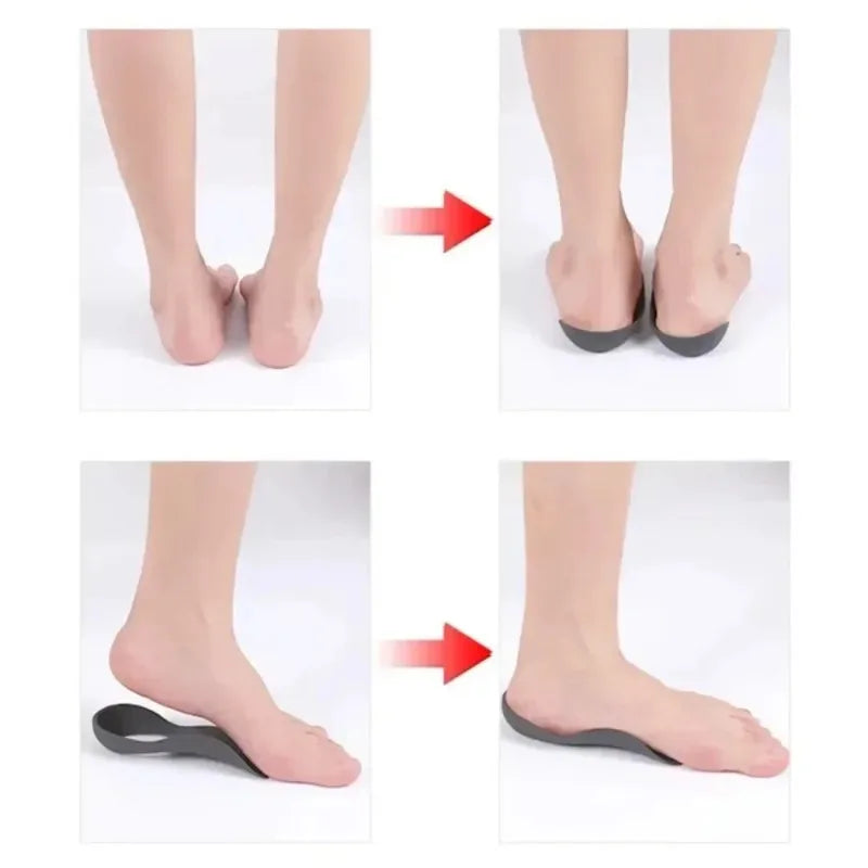 Arch Support Orthotic Insoles for Flat Feet & Plantar Fasciitis Orthotic Shoe Insoles Peaceful Pleasures Health and Wellness