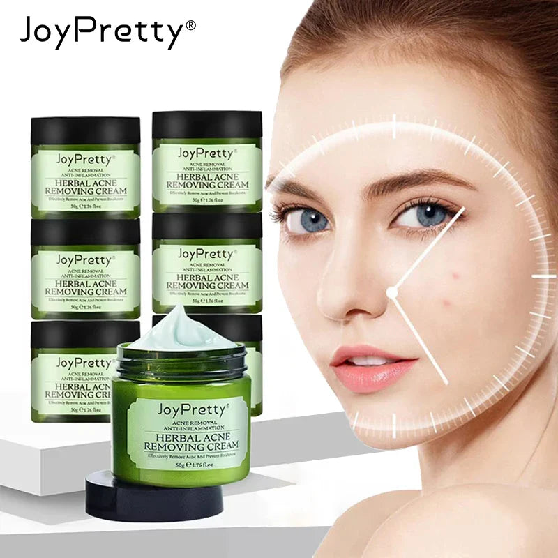 JoyPretty Blackhead Remover & Pore Minimizing Face Cream Set