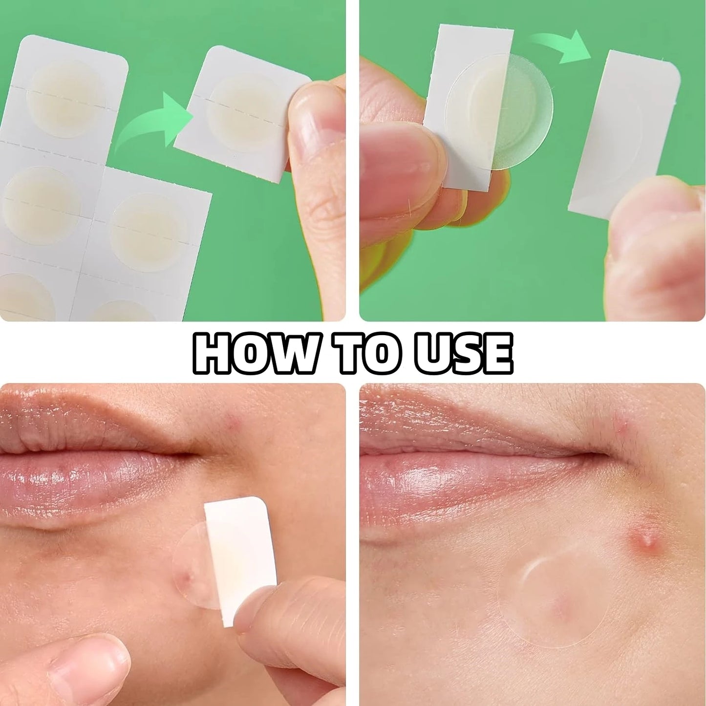 Invisible Waterproof Hydrocolloid Acne Patches – All Skin Types