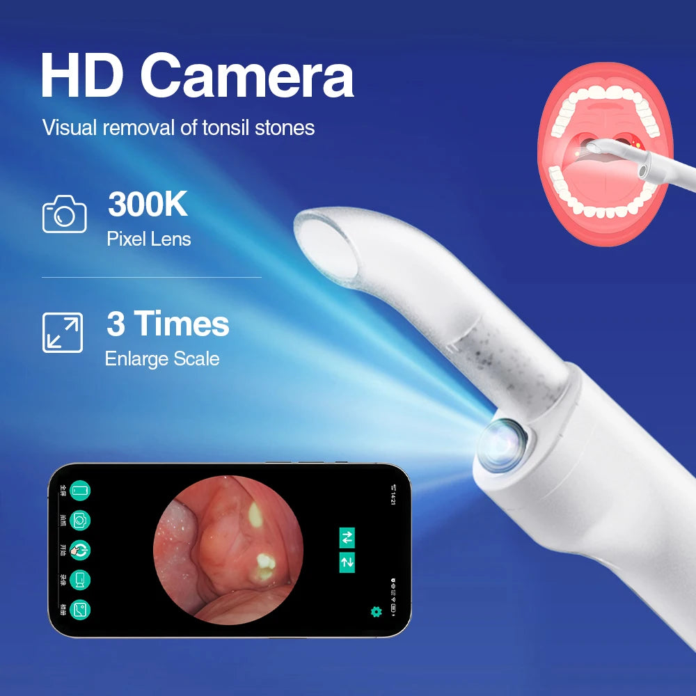 Vacuum Visual Electric Tonsil Stone Remover Oral Irrigator&Tongue Coating Scraper Built-In LED light 8 Suction Anti Bad Breath Peaceful Pleasures Health and Wellness