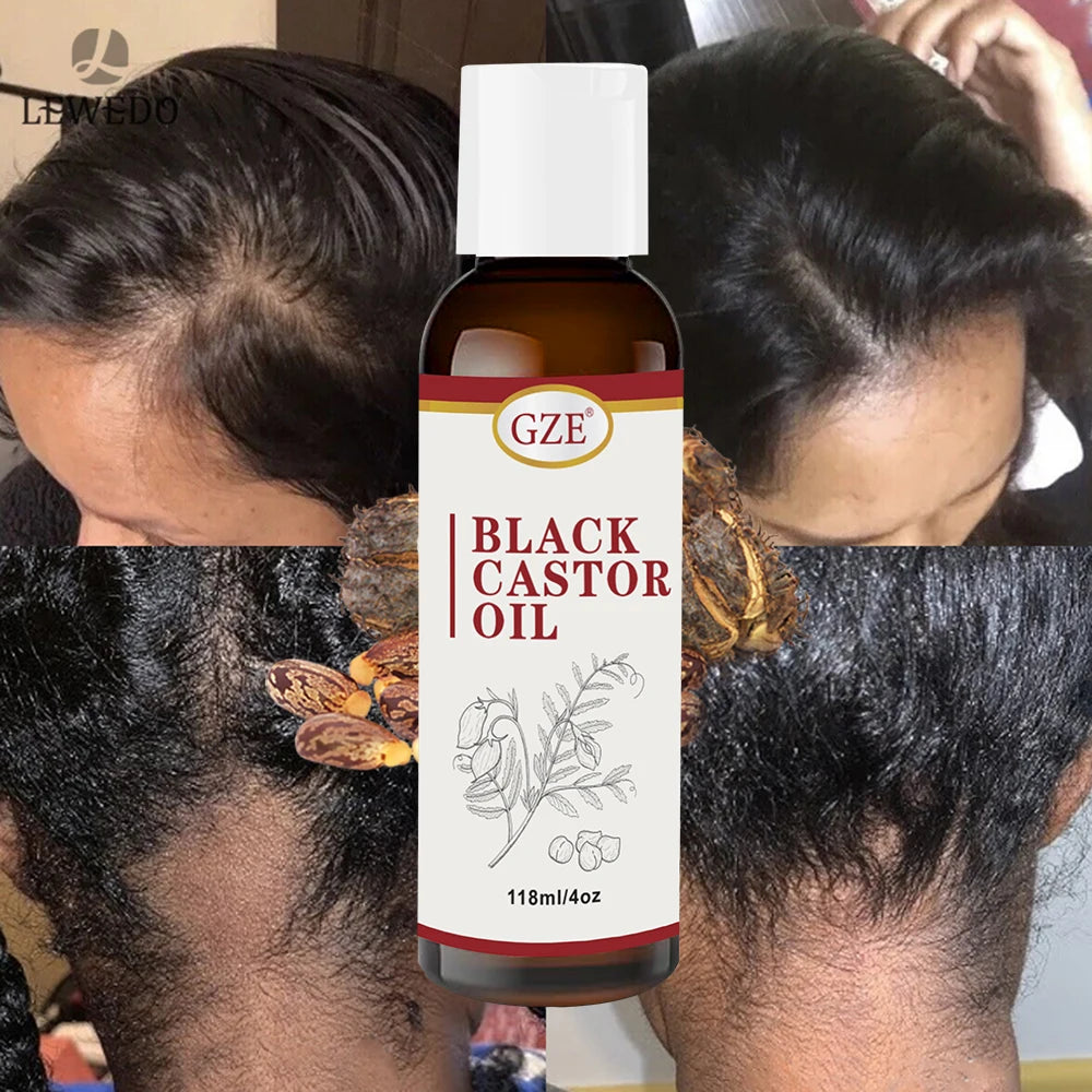 Jamaican Black Castor Oil – Strengthens Hair & Nourishes Skin