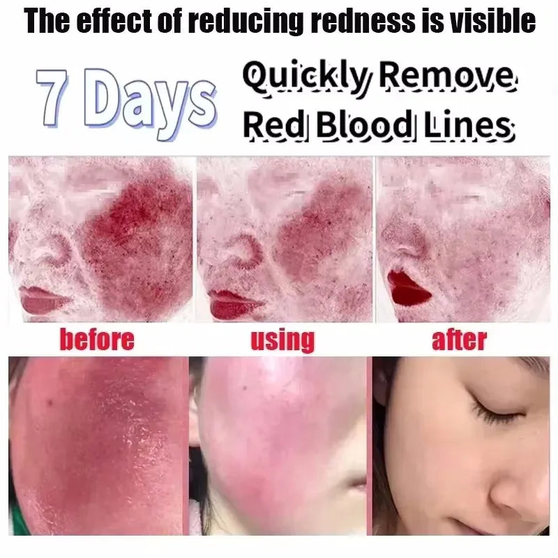 Facial Redness Repair Serum | Rosacea & Sensitive Skin Relief