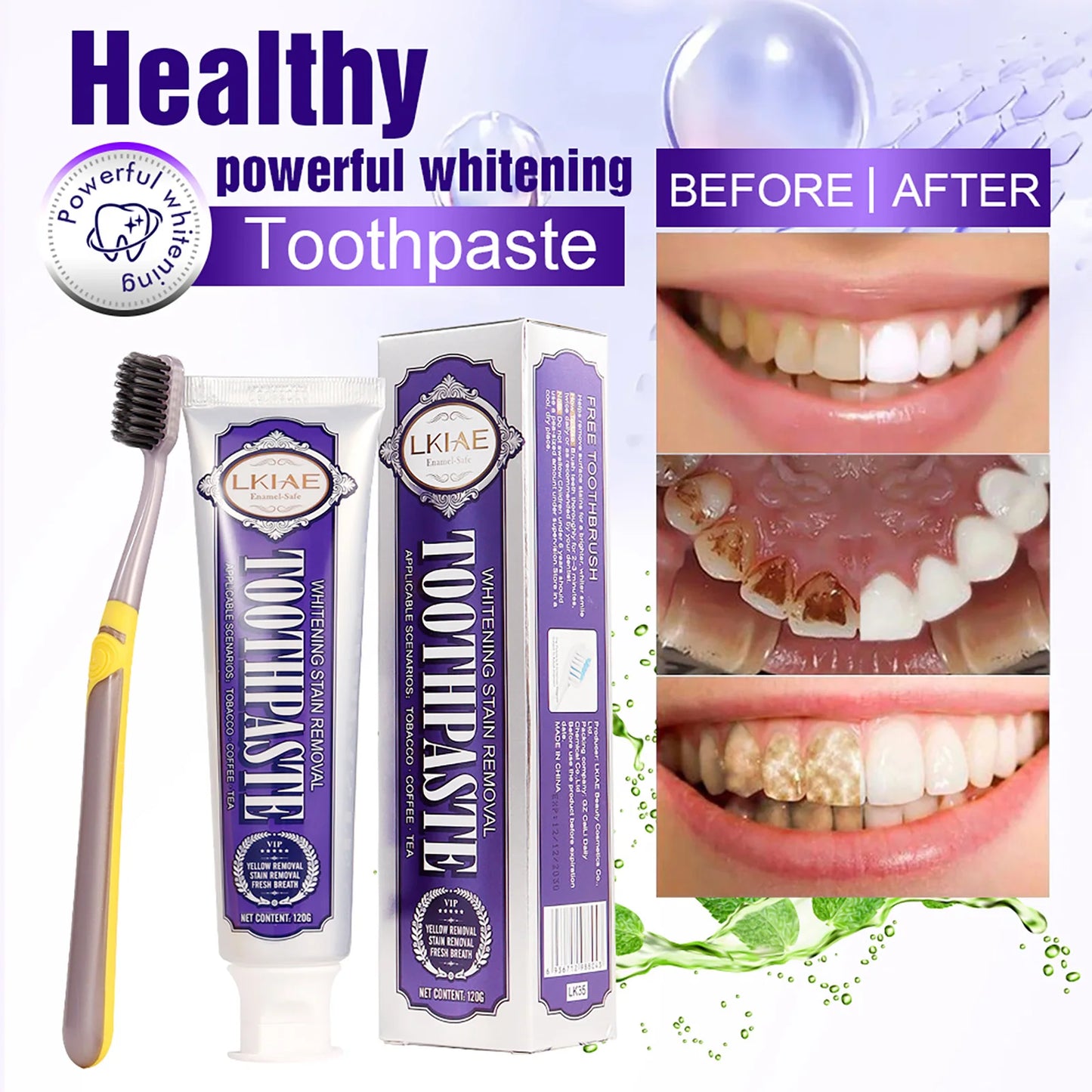 LKIAE Whitening Toothpaste | Stain Removal & Fresh Breath Mint