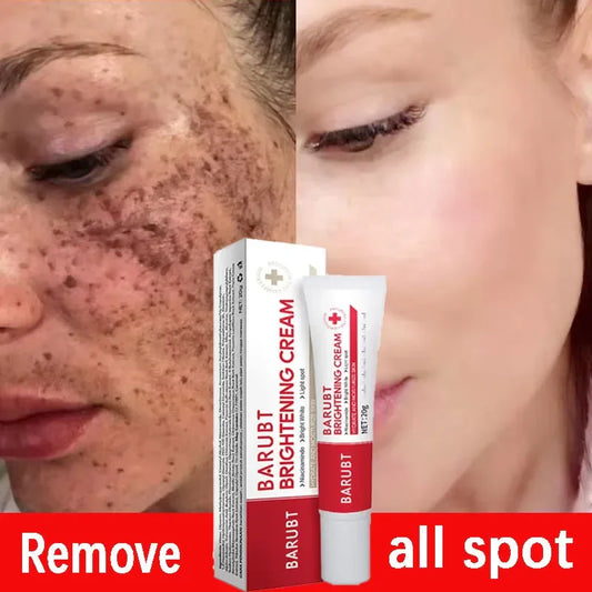 Brightening Dark Spot Corrector Cream – Niacinamide & Vitamin C Brightening Face Cream Oasis Select