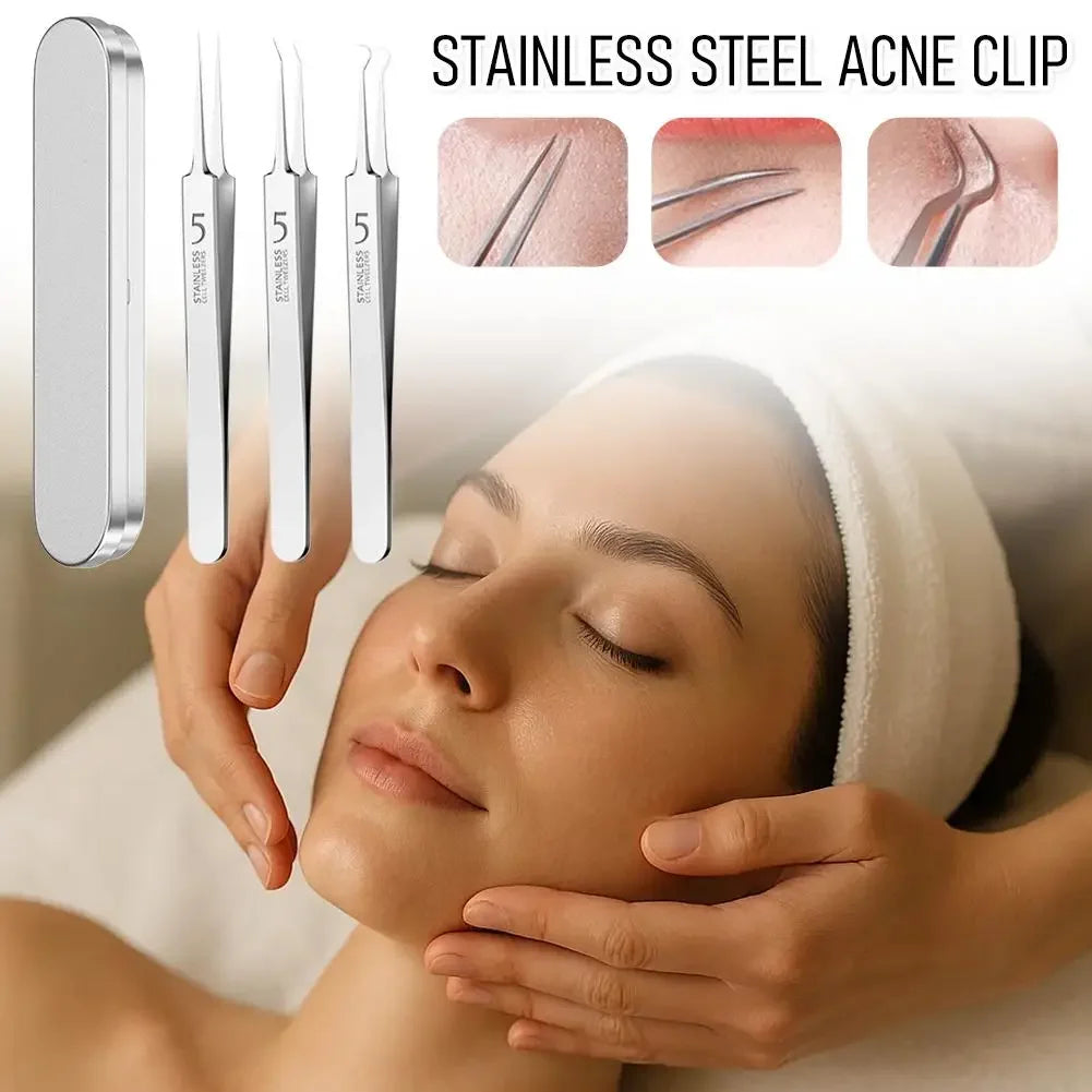 Professional Facial Blackhead Remover Tweezers,3Pcs Precision Pimple Popper Tool Kit for Whitehead Ance Blemishs Comedones Peaceful Pleasures Health and Wellness