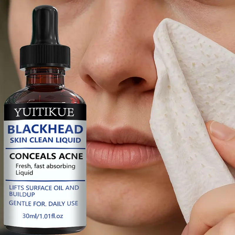 YUITIKUE Blackhead Remover Liquid Gentle Acne Oil Control Deep Cleansing Pore Refining Skin Care Peaceful Pleasures Health and Wellness