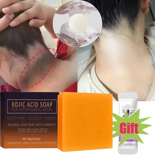 Kojic Acid Brightening Soap – Dark Spot & Deep Cleanse Bar Brightening Cleansing Soap Oasis Select