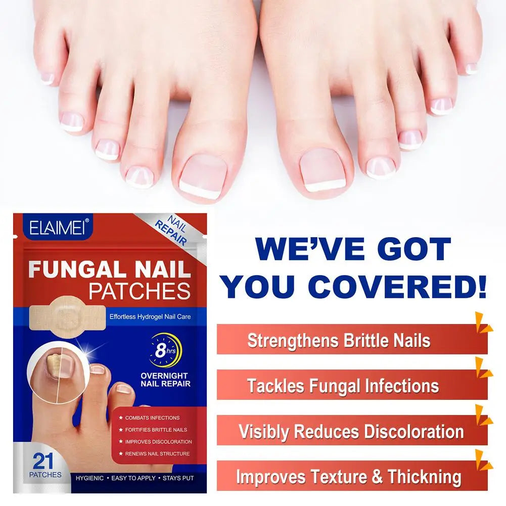 21pc Gray Toe Nail Sticker Fungal Nail Repair Patch Ingrown Correction Sticker Toenail Care Paronychia Nail Treatment Patch CarE Peaceful Pleasures Health and Wellness