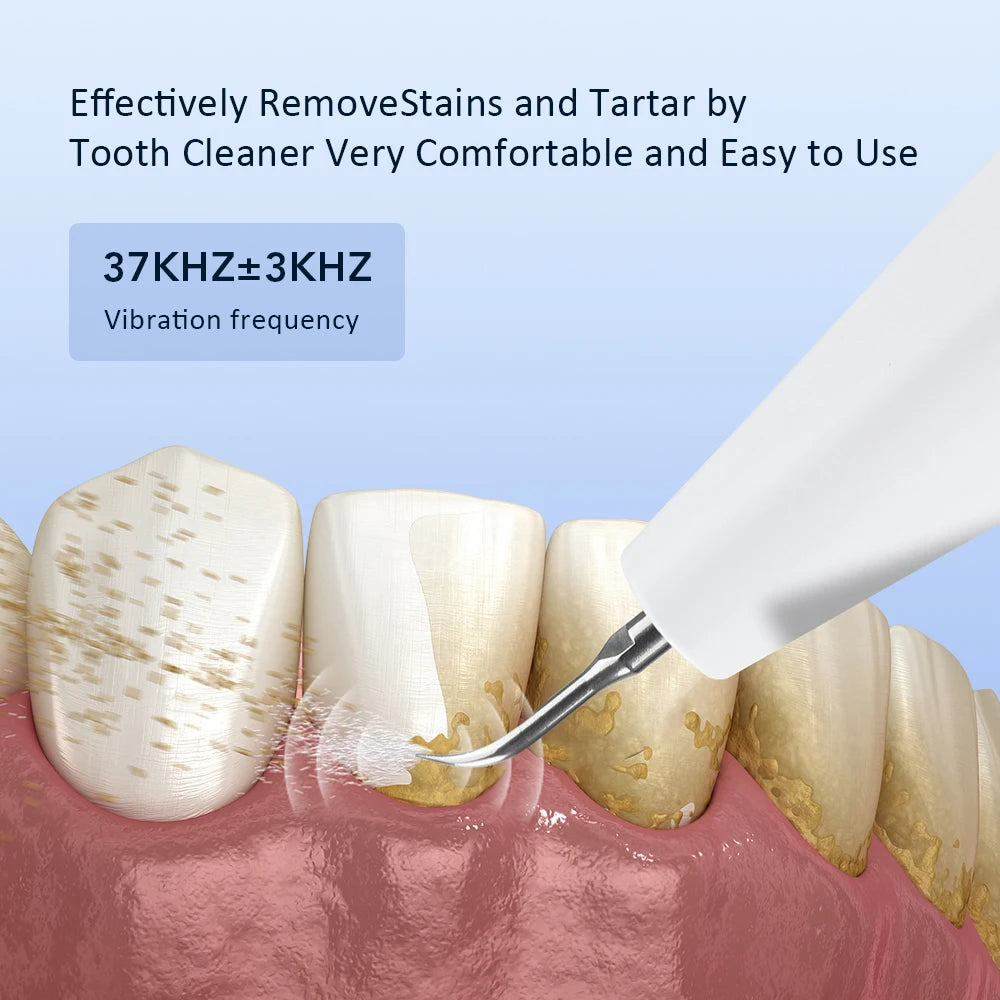 Pro Electric Tartar Remover Ultrasonic Home Dental Scaler 3 Mode Teeth Cleaner for Plaque Calculus Stains Removal Oral Care Tool Peaceful Pleasures Health and Wellness