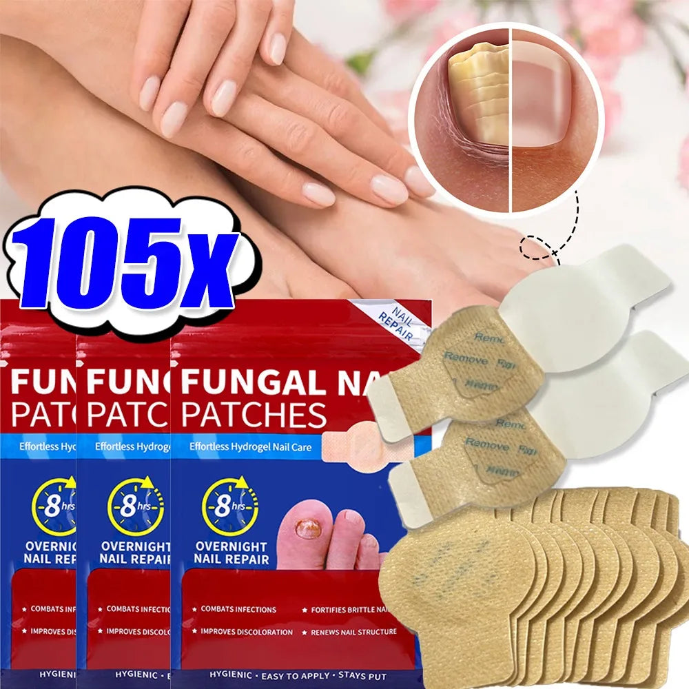 Nail Repair Patches – Ingrown Toenail & Nail Care Stickers