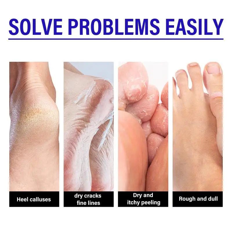 Foot Care Cream, Gentle Exfoliating, Moisturizing, Daily Foot Care Cream For Heels. Peaceful Pleasures Health and Wellness