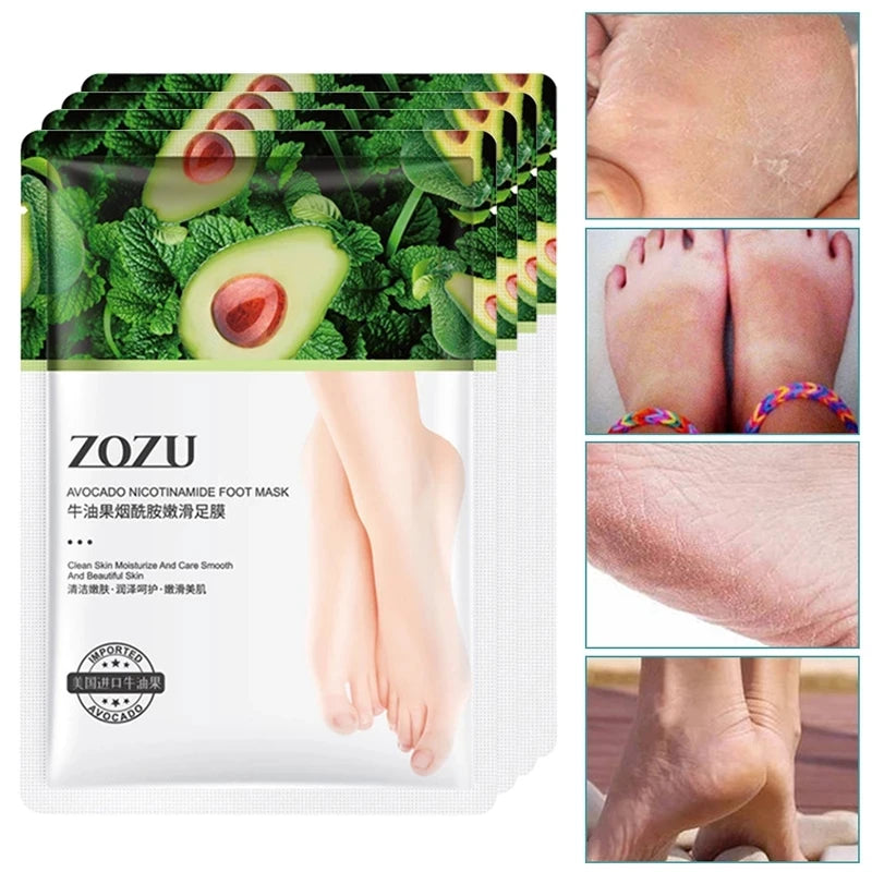 5-Pair Avocado Exfoliating Foot Mask – Dead Skin Remover
