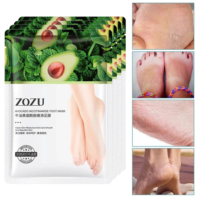 5-Pair Avocado Exfoliating Foot Mask – Dead Skin Remover & Moisturizer