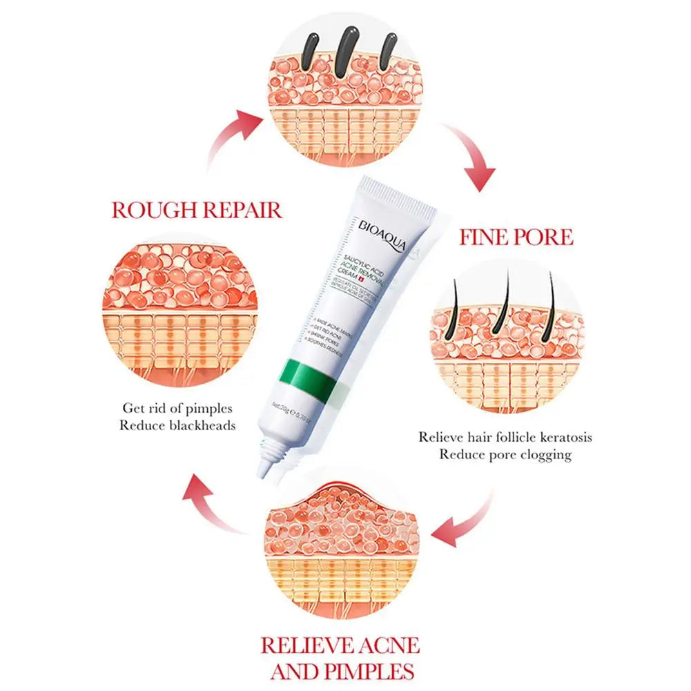 BIOAQUA Salicylic Acid Acne Cream – Oil Control & Pore Minimizer