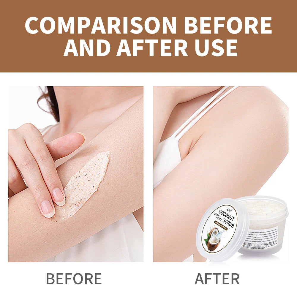 Coconut Exfoliating Body Scrub – Removes Dead Skin & Hydrates