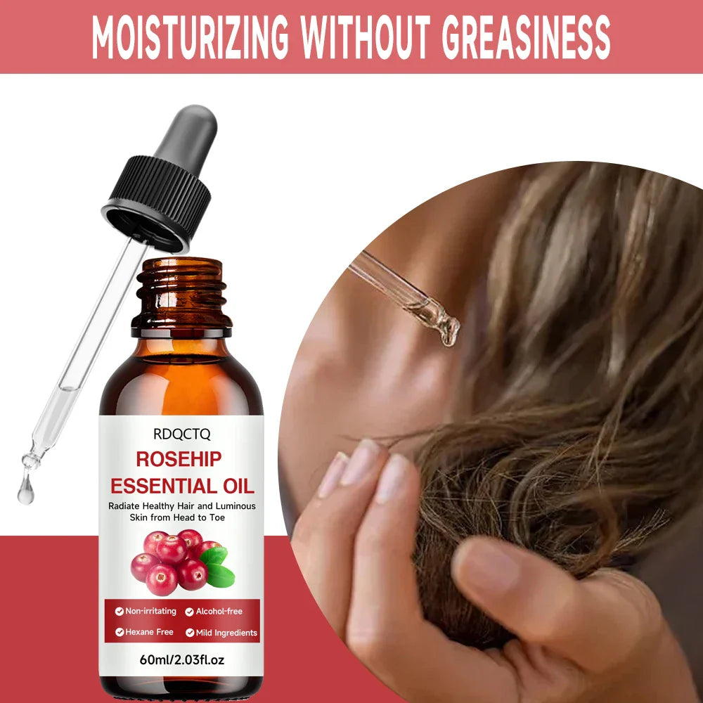 Rosehip Oil for Hair & Skin – Pure Natural Moisturizing Oil