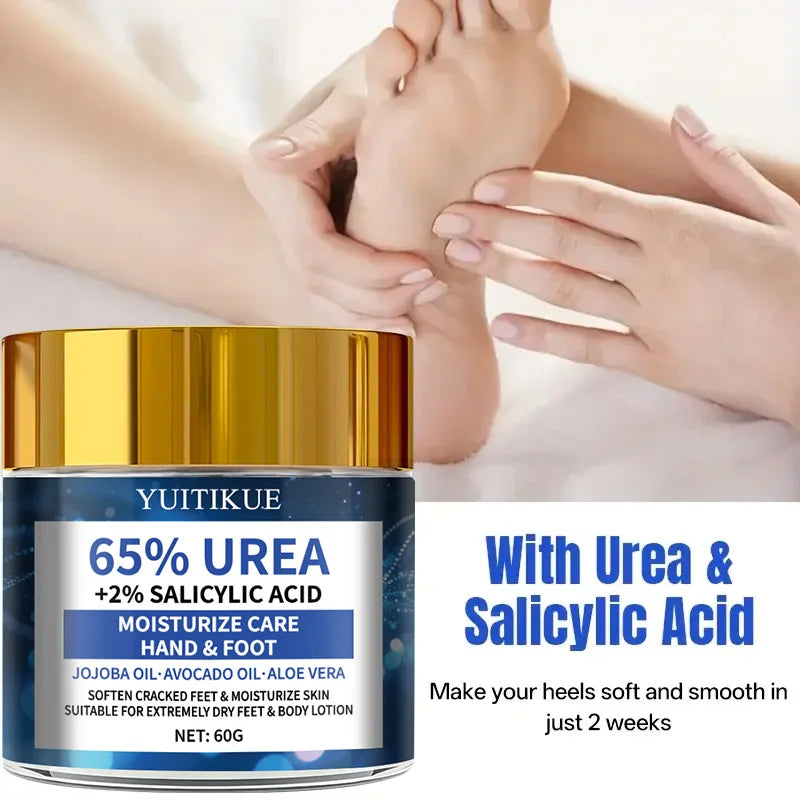 YUITIKUE 65% Urea Foot Cream – Cracked Heel Repair 60g Urea Foot Cream Peaceful Pleasures Health and Wellness